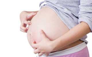 Гестационные синдромы: внутрипеченочный холестаз беременных и как с ним бороться?