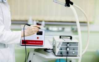 Что такое радиоволновая биопсия шейки матки, в каких случаях она назначается и как проводится?