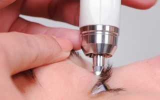 Какие существуют методы измерения глазного давления