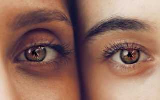 Что такое ретинит глаза: симптомы и лечения