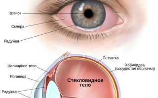 Заболевание эндофтальмит глаза: причины и лечение недуга